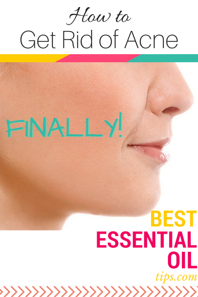 Image showcasing How to Get Rid of Acne (FINALLY!) | Best Essential Oil Tips